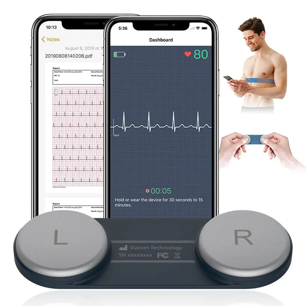 ECG Monitors